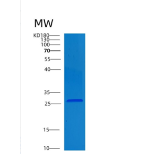 Recombinant Human CLNS1A Protein,Recombinant Human CLNS1A Protein