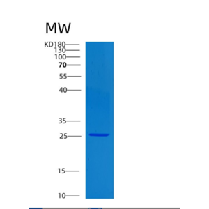 Recombinant Human CLTB Protein