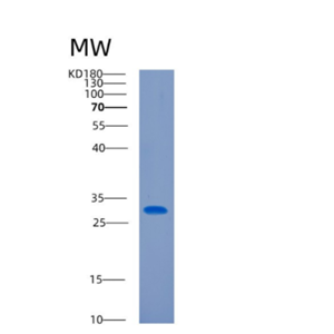 Recombinant Human CITED2 Protein,Recombinant Human CITED2 Protein