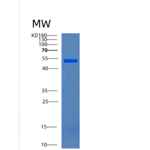 Recombinant Human CNDP2 Protein