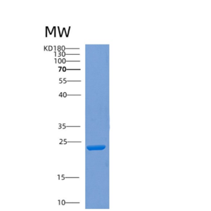 Recombinant Human COMMD7 Protein