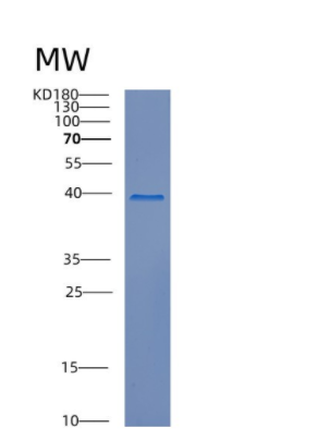 Recombinant Human CREBZF Protein,Recombinant Human CREBZF Protein