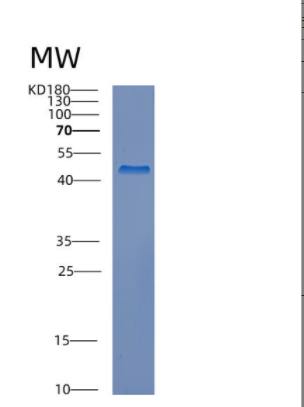 Recombinant Human CREB3L2 Protein,Recombinant Human CREB3L2 Protein