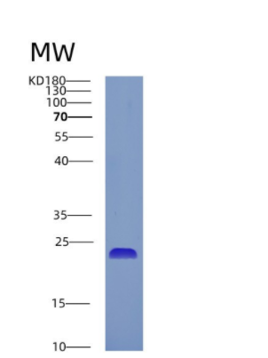 Recombinant Human CRYGC Protein,Recombinant Human CRYGC Protein