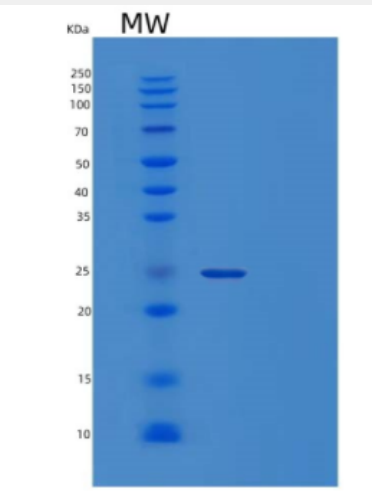 Recombinant Human CRYBA4 Protein,Recombinant Human CRYBA4 Protein