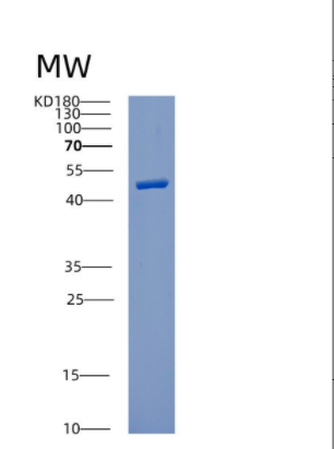 Recombinant Human CUL1 Protein,Recombinant Human CUL1 Protein