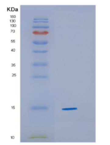 Recombinant Human CYB5A Protein,Recombinant Human CYB5A Protein