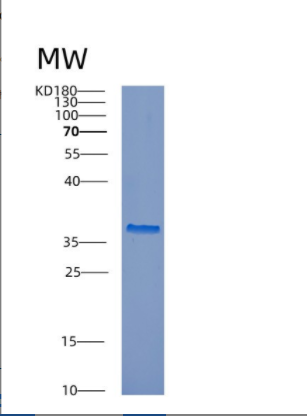 Recombinant Mouse Ctsl Protein,Recombinant Mouse Ctsl Protein