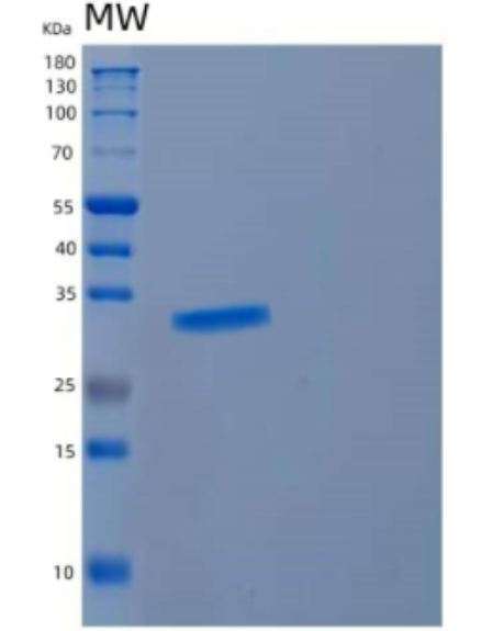 Recombinant Human CYB5R2 Protein,Recombinant Human CYB5R2 Protein