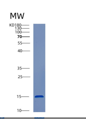 Recombinant Human CST3 Protein,Recombinant Human CST3 Protein