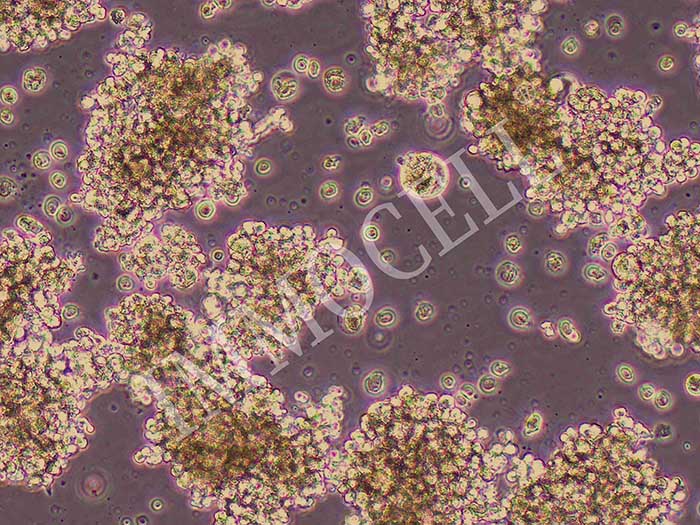 SU-DHL-2人B细胞淋巴瘤细胞,SU-DHL-2