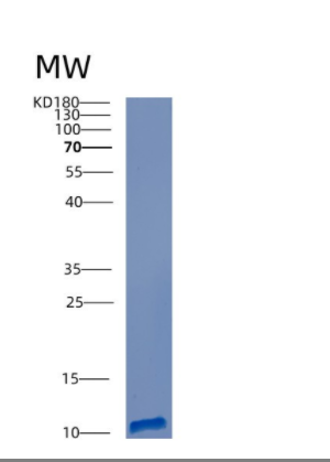 Recombinant Human CTNNBIP1 Protein,Recombinant Human CTNNBIP1 Protein