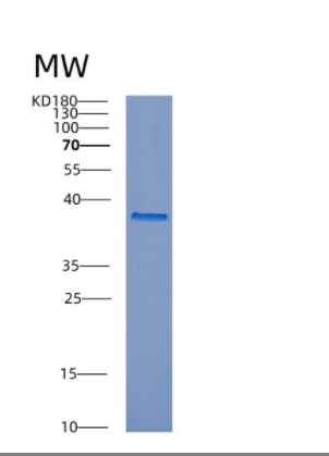 Recombinant Human CTSL Protein,Recombinant Human CTSL Protein