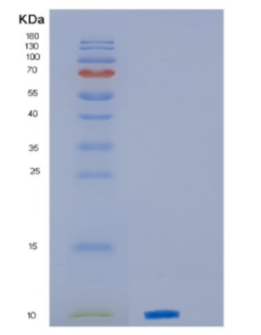 Recombinant Human CXCL4 Protein,Recombinant Human CXCL4 Protein