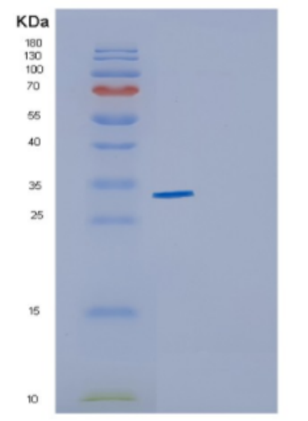 Recombinant Human CYB5R1 Protein,Recombinant Human CYB5R1 Protein