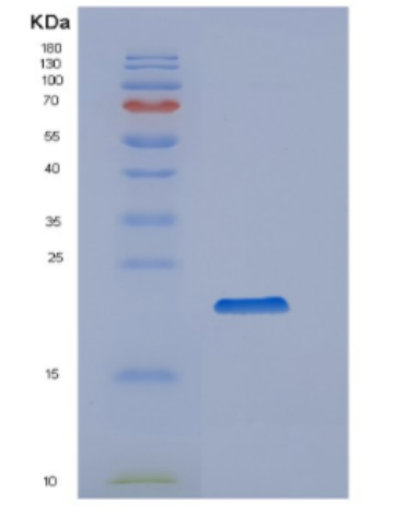 Recombinant Human Cyclophilin B Protein,Recombinant Human Cyclophilin B Protein