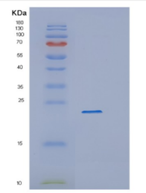 Recombinant Human CYGB Protein,Recombinant Human CYGB Protein