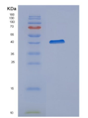 Recombinant Human Cyclophilin D(PPID) Protein,Recombinant Human Cyclophilin D(PPID) Protein