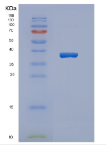 Recombinant Human CYTH2 Protein,Recombinant Human CYTH2 Protein