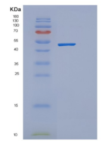 Recombinant Human Cytokine receptor common subunit beta Protein,Recombinant Human Cytokine receptor common subunit beta Protein