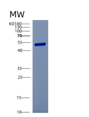 Recombinant Human CSTF1 Protein,Recombinant Human CSTF1 Protein