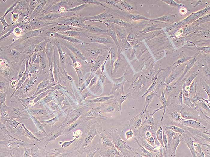 人乳腺癌成纤维细胞永生化,immocell