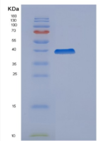 Recombinant Human Cyclin H Protein,Recombinant Human Cyclin H Protein