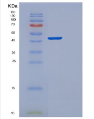 Recombinant Human CYTH1 Protein,Recombinant Human CYTH1 Protein