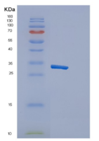 Recombinant Human Cytotoxic and regulatory T-cell molecule Protein,Recombinant Human Cytotoxic and regulatory T-cell molecule Protein