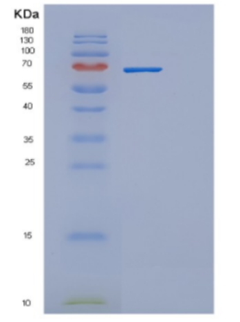 Recombinant Human DBH Protein,Recombinant Human DBH Protein