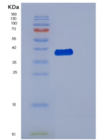 Recombinant Human DBR1 Protein,Recombinant Human DBR1 Protein