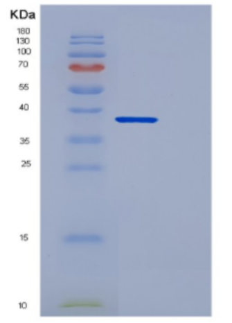 Recombinant Human DCN Protein,Recombinant Human TAU Protein