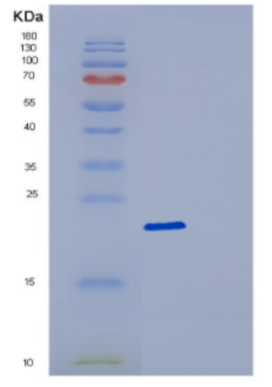 Recombinant Human DCTD Protein,Recombinant Human DCTD Protein