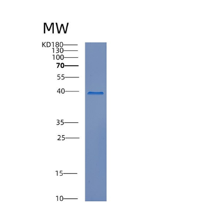 Recombinant Human CREBZF Protein,Recombinant Human CREBZF Protein