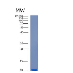 Recombinant Human CRIP1 Protein