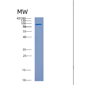 Recombinant Human CRS (Cysteinyl tRNA synthetase) Protein