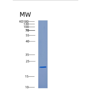 Recombinant Human CRYAB(Crystallin α B) Protein