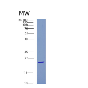 Recombinant Human CRYGS Protein,Recombinant Human CRYGS Protein