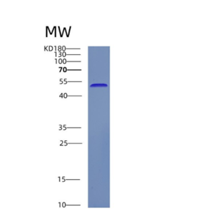 Recombinant Human CSK Protein