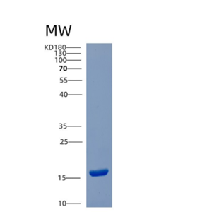 Recombinant Human CST6 Protein,Recombinant Human CST6 Protein