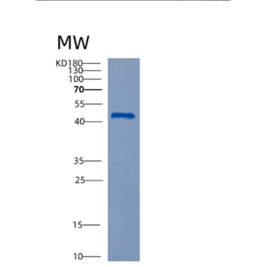 Recombinant Mouse Ctsd Protein,Recombinant Mouse Ctsd Protein