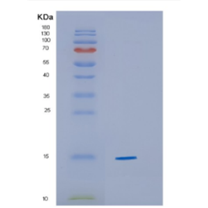 Recombinant Human CYB5A Protein,Recombinant Human CYB5A Protein