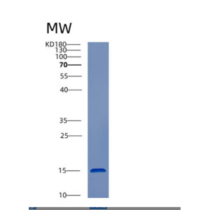 Recombinant Human CST3 Protein