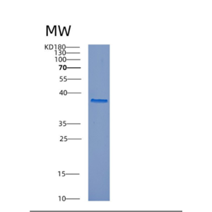 Recombinant Human CTSL Protein,Recombinant Human CTSL Protein