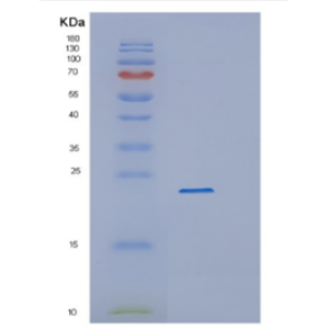 Recombinant Human CYGB Protein,Recombinant Human CYGB Protein