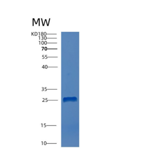 Recombinant Human CTHRC1 Protein