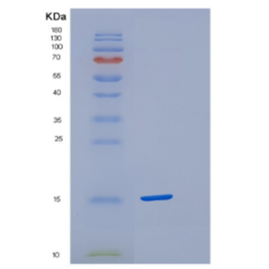 Recombinant Human Cystatin-S Protein