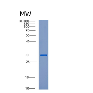 Recombinant Human CTSE Protein,Recombinant Human CTSE Protein