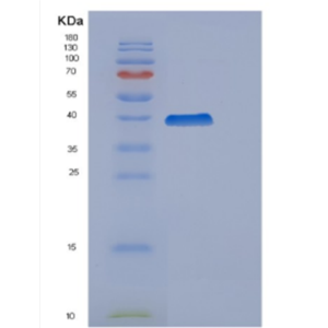 Recombinant Human Cyclin H Protein