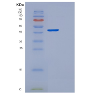 Recombinant Human CYTH1 Protein